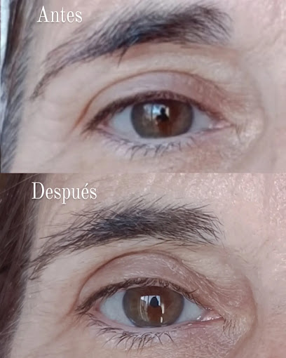 Fisiokv | Fisioterapeuta Kelly Vidal | Fisio Dermatofuncional En San Juan | San’T Joan D’Alacant