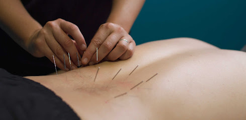 Myfisio Fisioterapia En Las Rozas